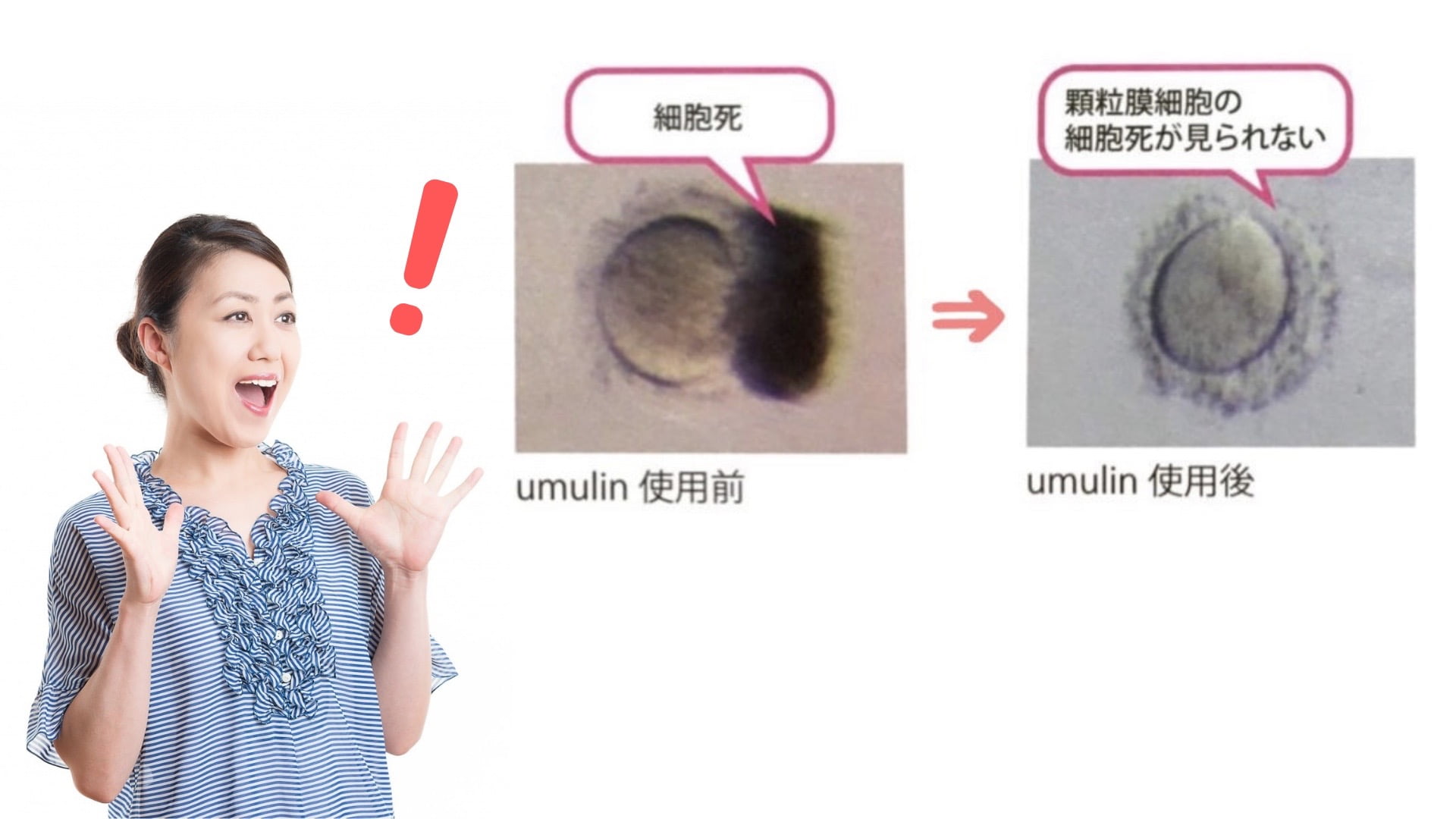卵子の質を改善するサプリはウムリン一択!医師も認める効果とは?
