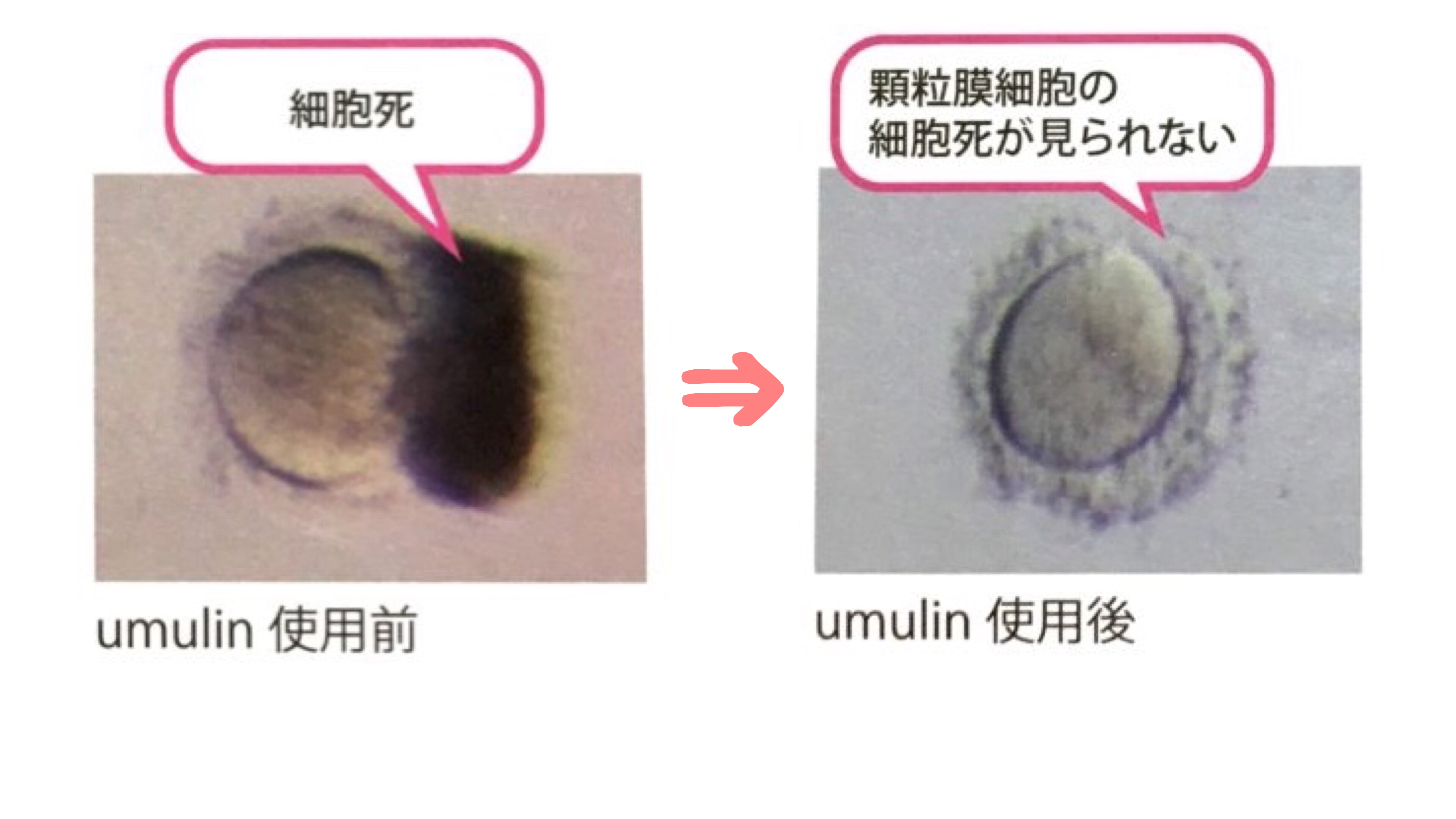 卵子の質&卵子の老化に作用するサプリは「ウムリン」一択!