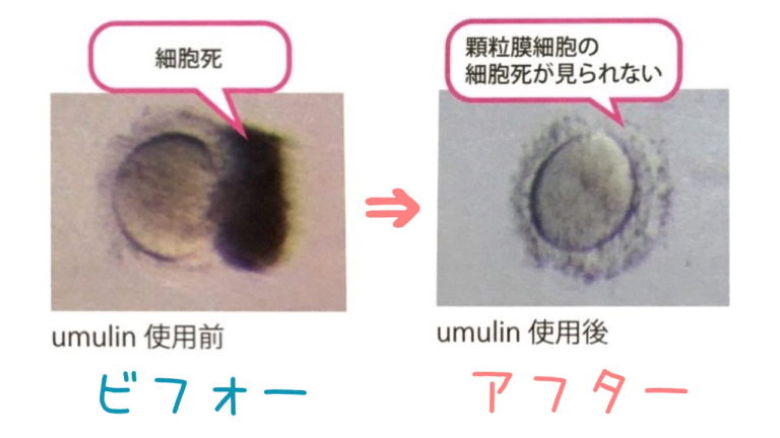 卵子の質を改善するサプリはウムリン一択!医師も認める効果とは?