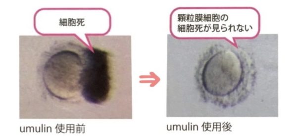 ウムリン 顆粒膜細胞保護
